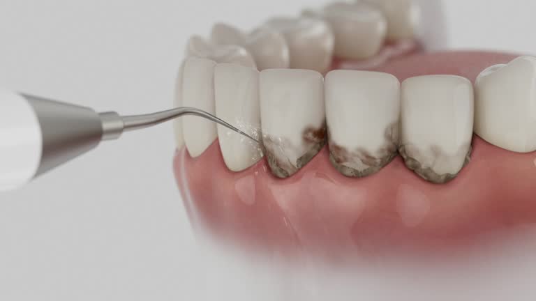 Reliable Tooth Extraction contractor in Columbia Falls, MT by Smile Center Dentistry